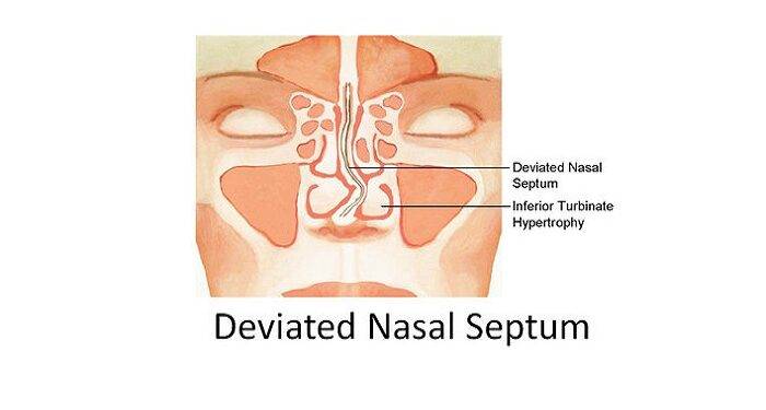 What is the Full Form of DNS in Pharmacy?